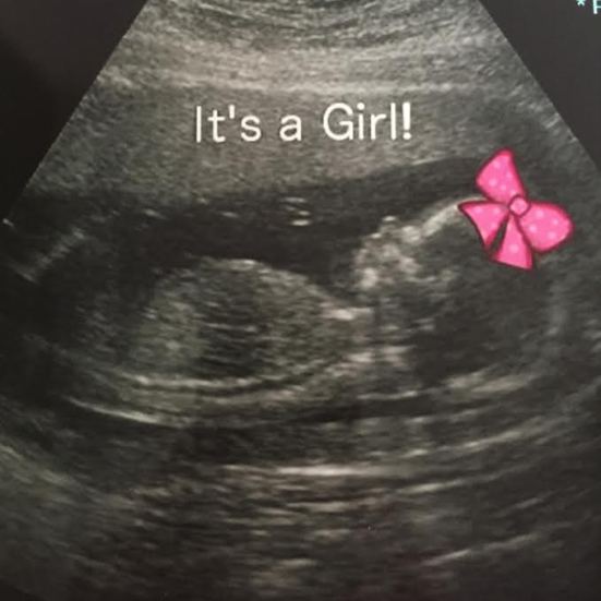 itsagirl